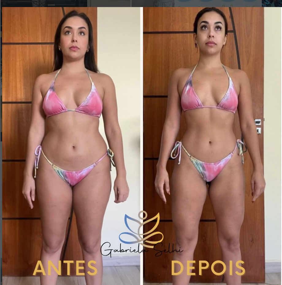 Antes e depois — resultado 5
